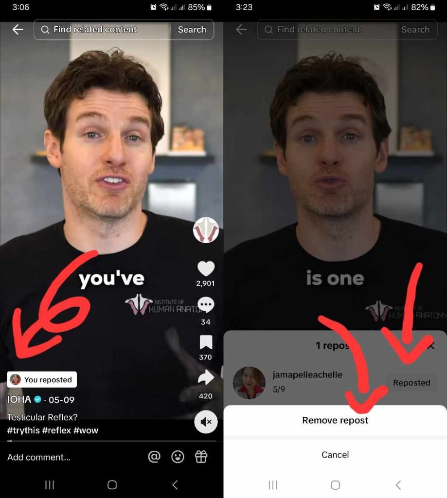 High Social’s screenshots show how to undo a Repost on TikTok. 
