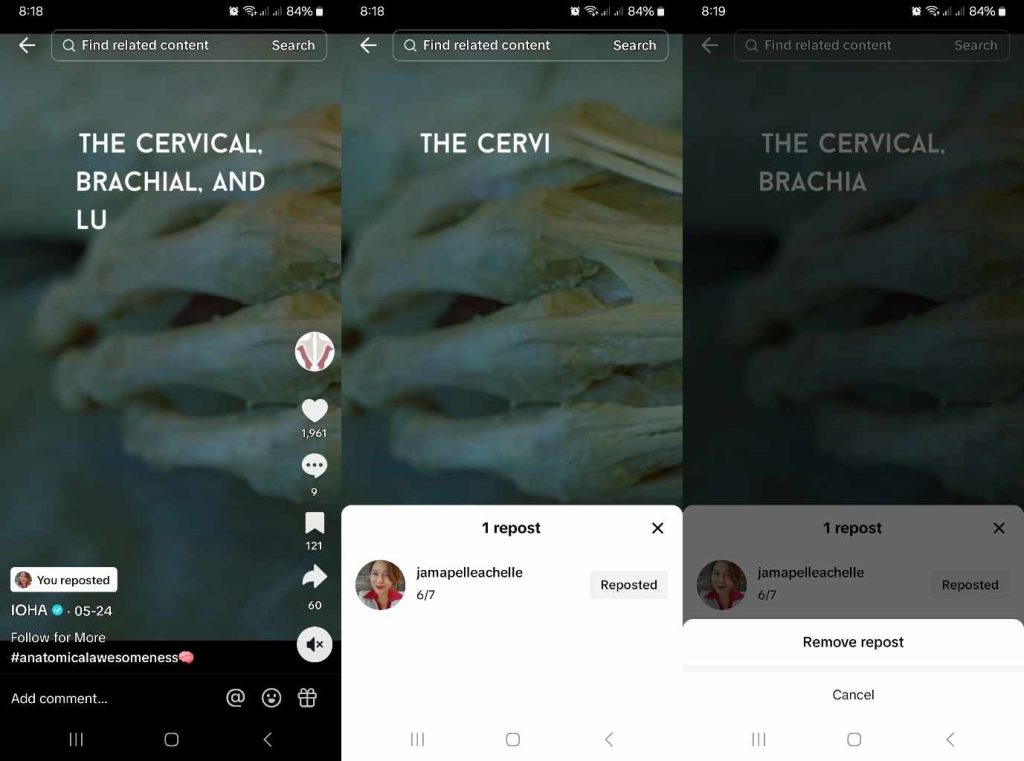 High Social’s screenshots show how to undo a repost on TikTok. 

